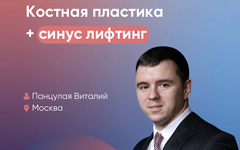 Костная пластика + синус-лифтинг