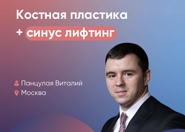 Костная пластика + синус-лифтинг