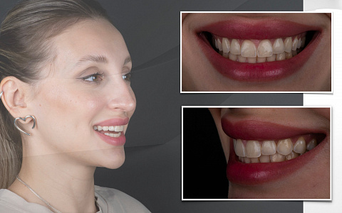 Дентальный фотопротокол