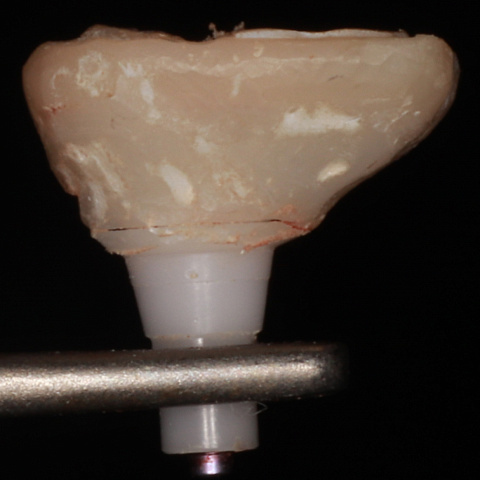 Изготовление индивидуального ФДМ 