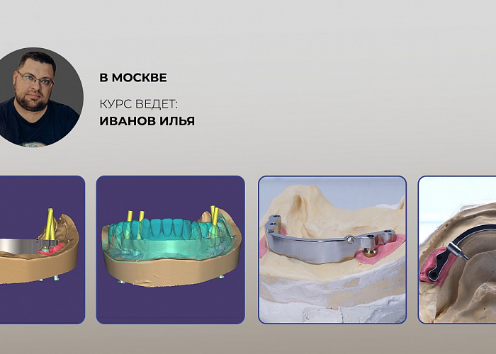 Балки и ответные части