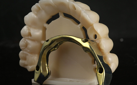 «Протокол тотального протезирования при полной адентии»