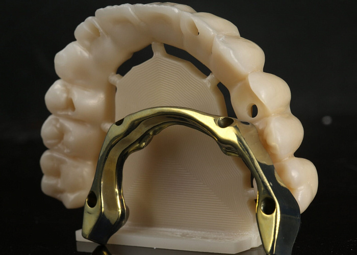 «Протокол тотального протезирования при полной адентии»