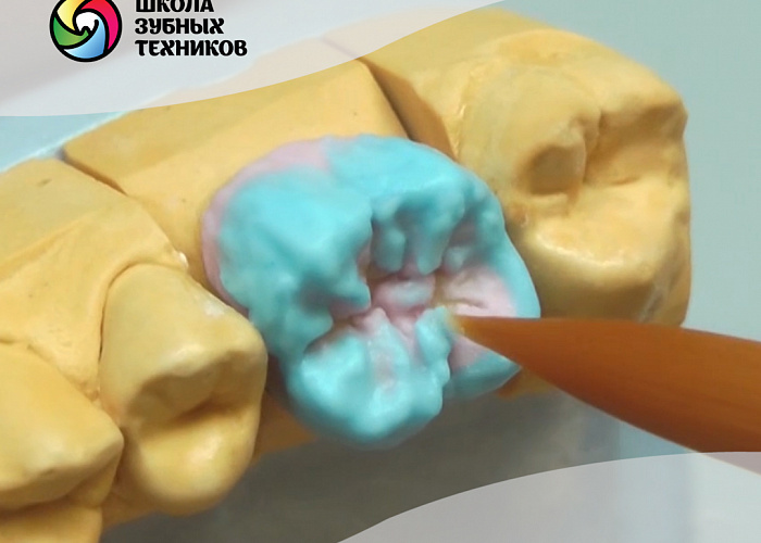 Изготовление металлокерамических коронок. База