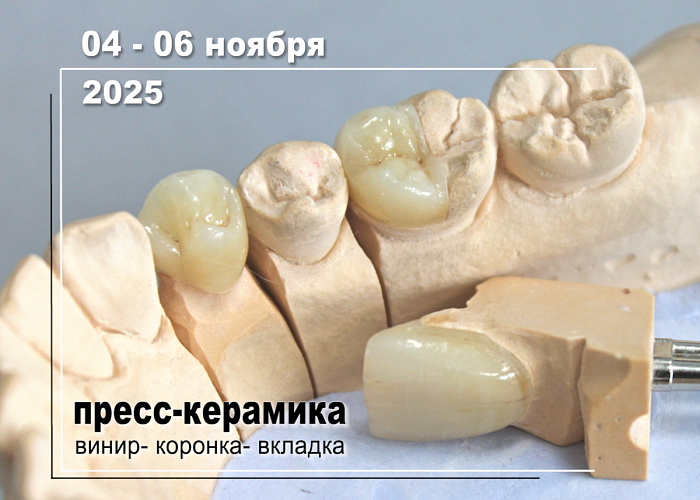 Технология создания виниров, коронок, вкладок Inlay/Onlay из пресс-керамики E-max