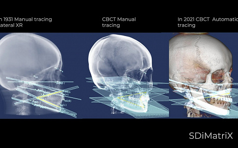 «ЦИФРОВАЯ ГНАТОЛОГИЯ. Цифровые функциональные протоколы в диагностике и планировании ортопедического и ортодонтического лечения»