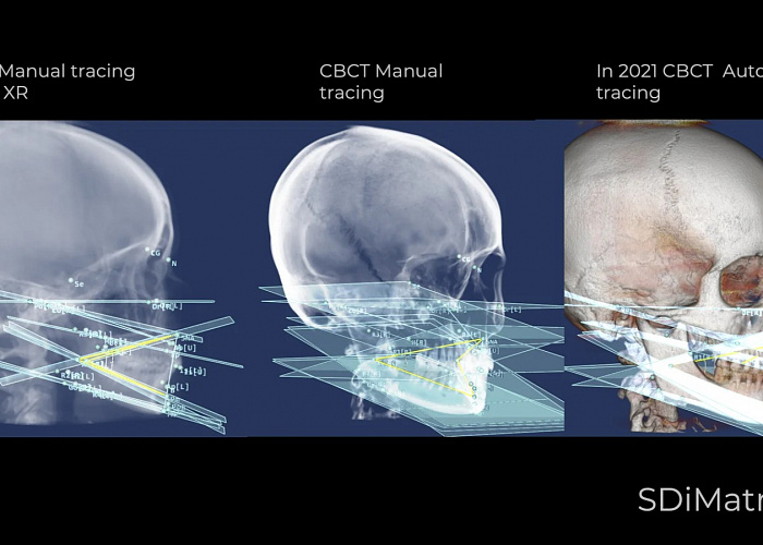 «ЦИФРОВАЯ ГНАТОЛОГИЯ. Цифровые функциональные протоколы в диагностике и планировании ортопедического и ортодонтического лечения»