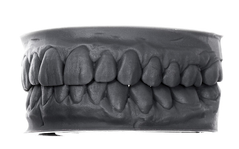 «Моделирование тотального Wax Up»