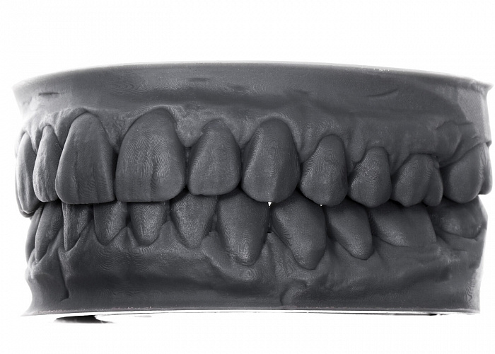 «Моделирование тотального Wax Up»