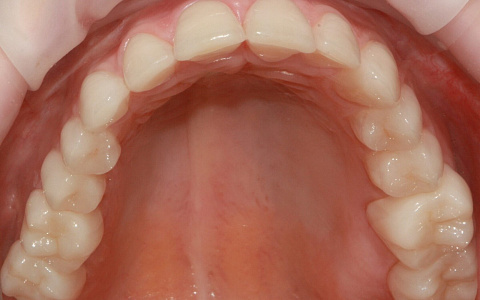 Цикл вебинаров ГНАТОЛОГИЯ НА МАКСИМАЛКАХ.