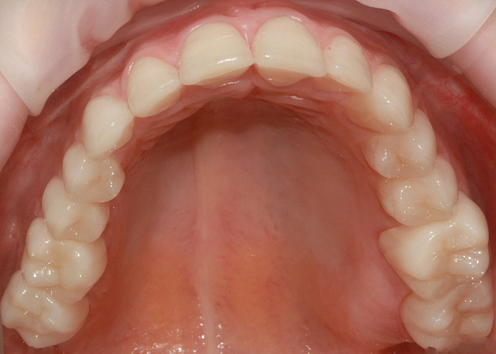 Цикл вебинаров ГНАТОЛОГИЯ НА МАКСИМАЛКАХ.
