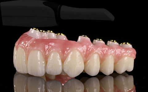 «Планирование работ на имплантатах»