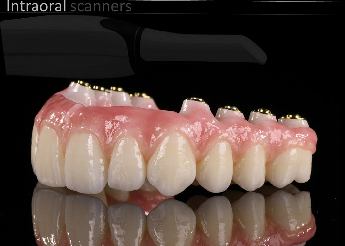 «Планирование работ на имплантатах»