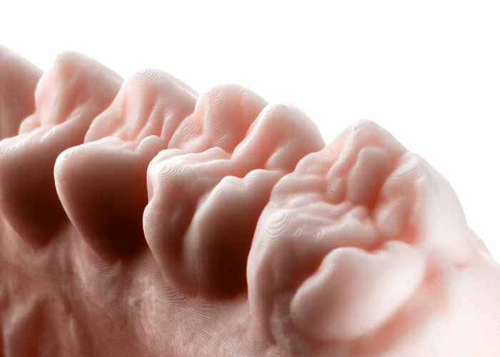 «3D печать в стоматологии и зуботехнической лаборатории»