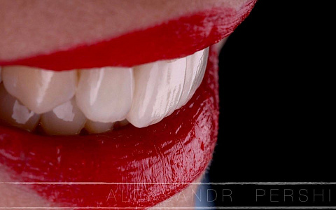 «Эстетическая реабилитация пациента при помощи виниров»