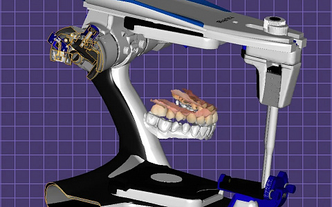 Антон АладинскийПрактикующий зубной техник, руководитель цифрового направления лаборатории Helios, инженер.  Стаж работы в цифре 8 лет. Exocad, 3shape