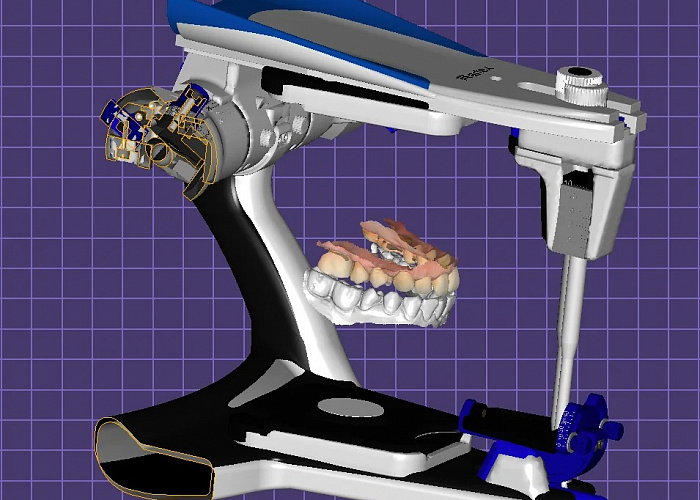 Антон АладинскийПрактикующий зубной техник, руководитель цифрового направления лаборатории Helios, инженер.  Стаж работы в цифре 8 лет. Exocad, 3shape