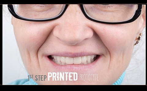 «Обзор интраоральных сканеров»