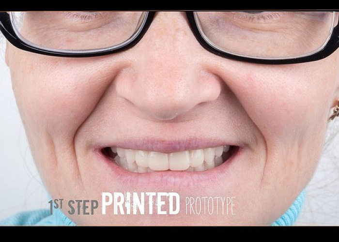 «Обзор интраоральных сканеров»