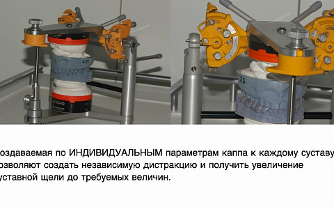 «Заниматься или лечить ВНЧС»