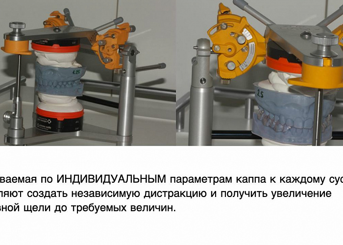 «Заниматься или лечить ВНЧС»