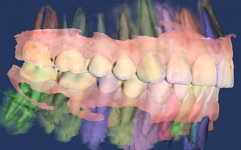 «Цифровая гнатология»