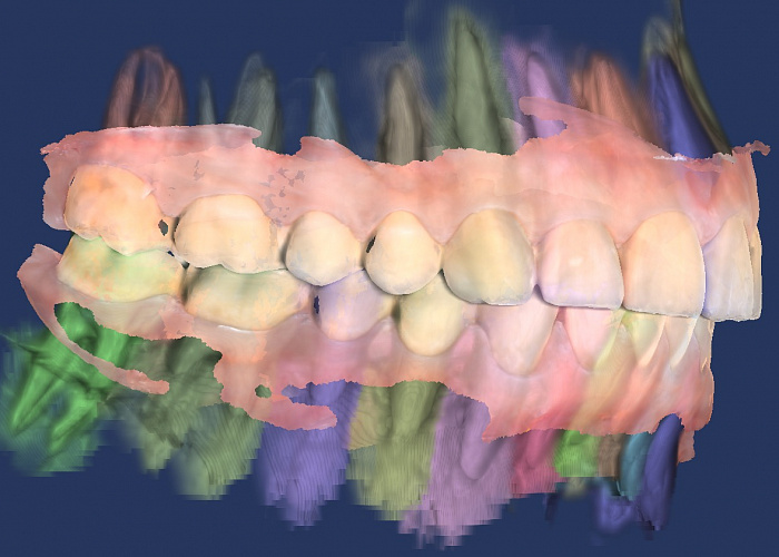 «Цифровая гнатология»