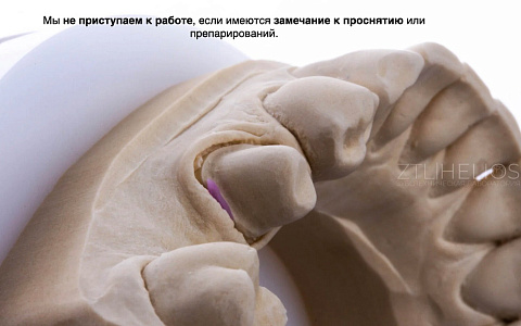 «Оптимизация работы зуботехнической лаборатории»