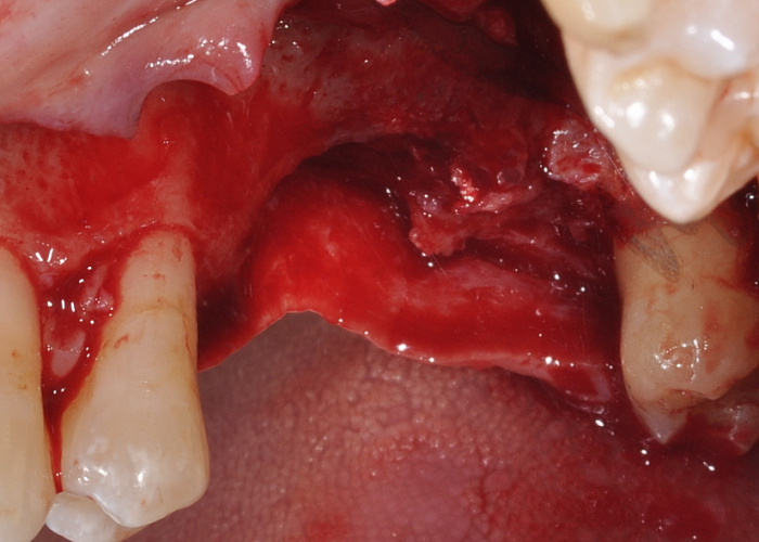 «Вертикальные аугментации - когда без них не обойтись»