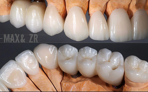 «Цифровой протокол в работе зубного техника»