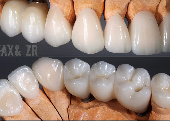 «Цифровой протокол в работе зубного техника»