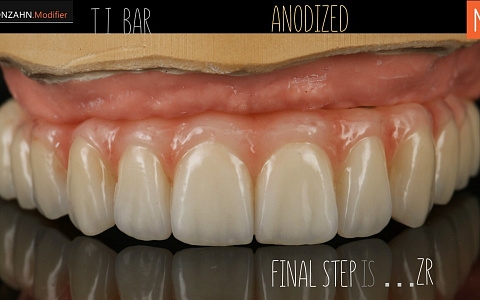 Серия бесплатных online вебинаров для зубных техников «Июньская серия бесплатных вебинаров - интенсивов»