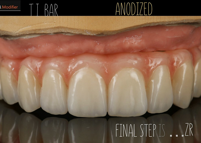 Серия бесплатных online вебинаров для зубных техников «Июньская серия бесплатных вебинаров - интенсивов»