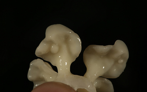 «Ручное прессование дисиликата лития»