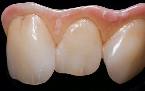 «Правильный выбор материалов, исходя из клинической ситуации и поставленных задач»