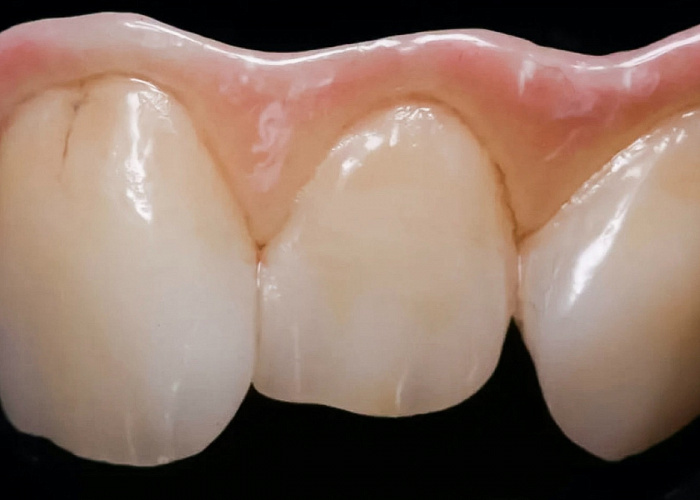 «Правильный выбор материалов, исходя из клинической ситуации и поставленных задач»