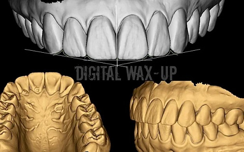 «Моделирование функции и эстетики в программе Exocad»