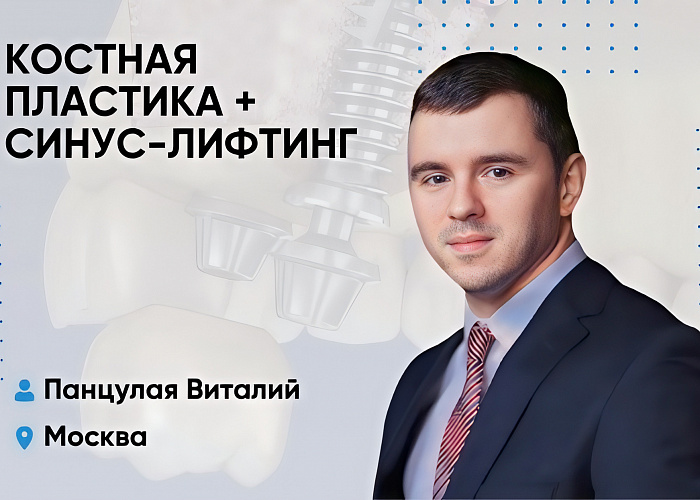 Костная пластика + синус-лифтинг
