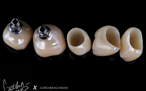 «Цельноциркониевые коронки с уровня имплантата. Винтовая фиксация»