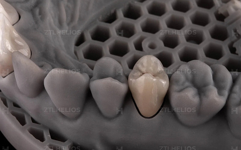 «Ceramiс Pro. Окрашивание, нанесение, морфология, цвет. Продвинутая работа с ZrO₂ и дисиликатом лития»