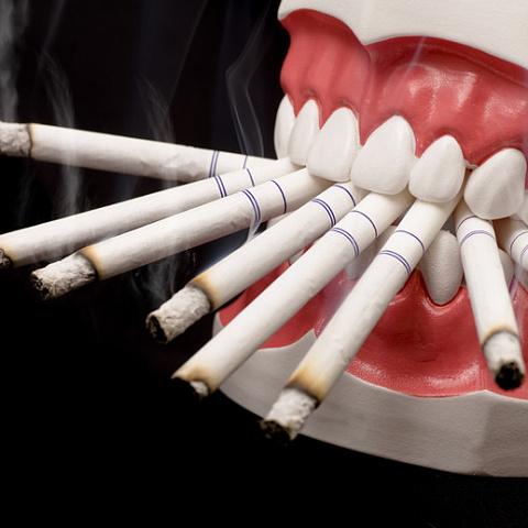 План установки зубных имплантатов следует корректировать для курящих пациентов