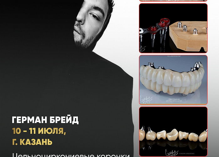  «Цельноциркониевые коронки с уровня имплантата. Винтовая фиксация»