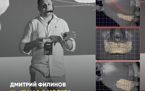 «Моделирование функции и эстетики в программе Exocad»