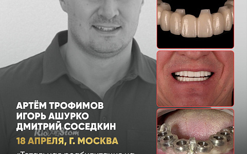 «Тотальная реабилитация на multi-unit абатментах в полном цифровом протоколе. Живая демонстрация на пациенте»