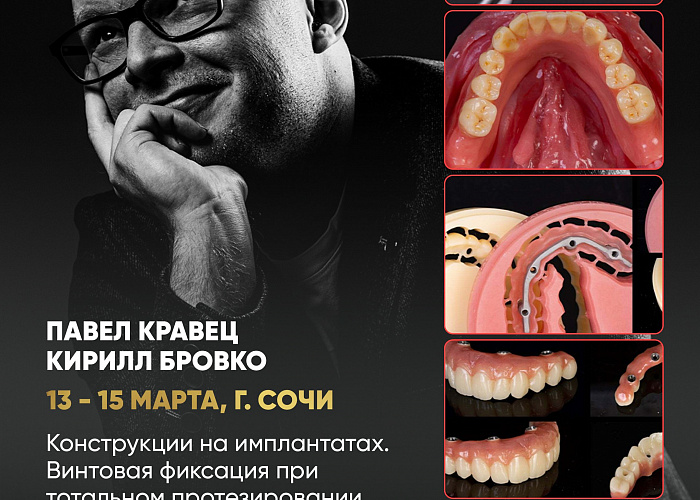 «Конструкции на имплантатах. Винтовая фиксация при тотальном протезировании. Условно-съёмные конструкции и работы на мультиюнитах»