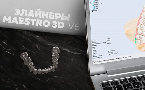Элайнеры | Maestro 3D V6 в практике врача-ортодонта и зубного техника