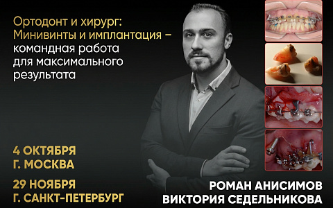«Ортодонт и хирург: Минивинты и имплантация – командная работа для максимального результата»