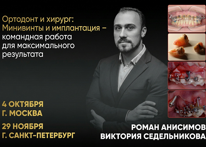 «Ортодонт и хирург: Минивинты и имплантация – командная работа для максимального результата»