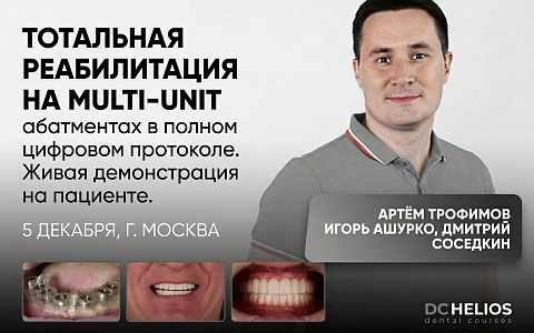 «Тотальная реабилитация на multi-unit абатментах в полном цифровом протоколе. Живая демонстрация на пациенте»