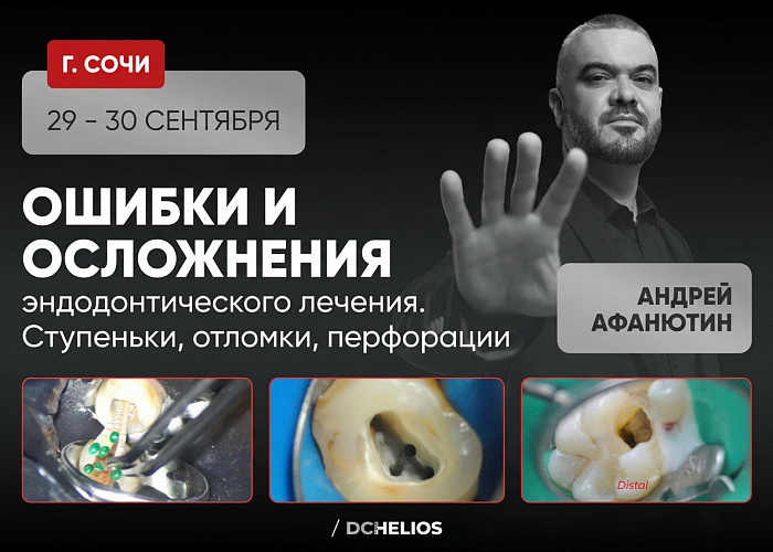 «Ошибки и осложнения эндодонтического лечения. Ступеньки, отломки, перфорации»